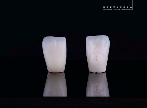 148道工序成就一顆德國精工好牙