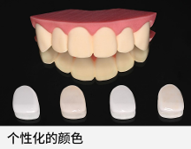 極薄強韌氧化鋯貼面技術，一款免磨牙貼面技術