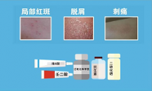 祛痘藥哪個好用？七味姜黃搽劑憑實力“出圈”，祛痘又猛又柔！