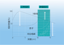 質(zhì)子治療兒童腫瘤一文詳解！