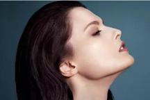 聯(lián)合麗格第 一醫(yī)院何照華院長：同是下頜U型截骨，為何術(shù)后骨骼形狀卻不同？